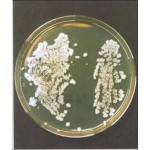 Test 4: Intestinal Candida & Fungi & Parasites & Leaky Gut & Intestinal Colonisation