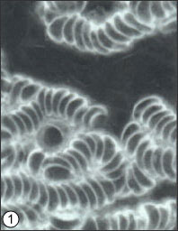 Cells Before Megahydrate