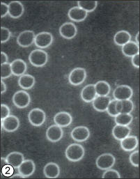 Cells After Megahydrate