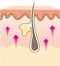 Skin Diagram